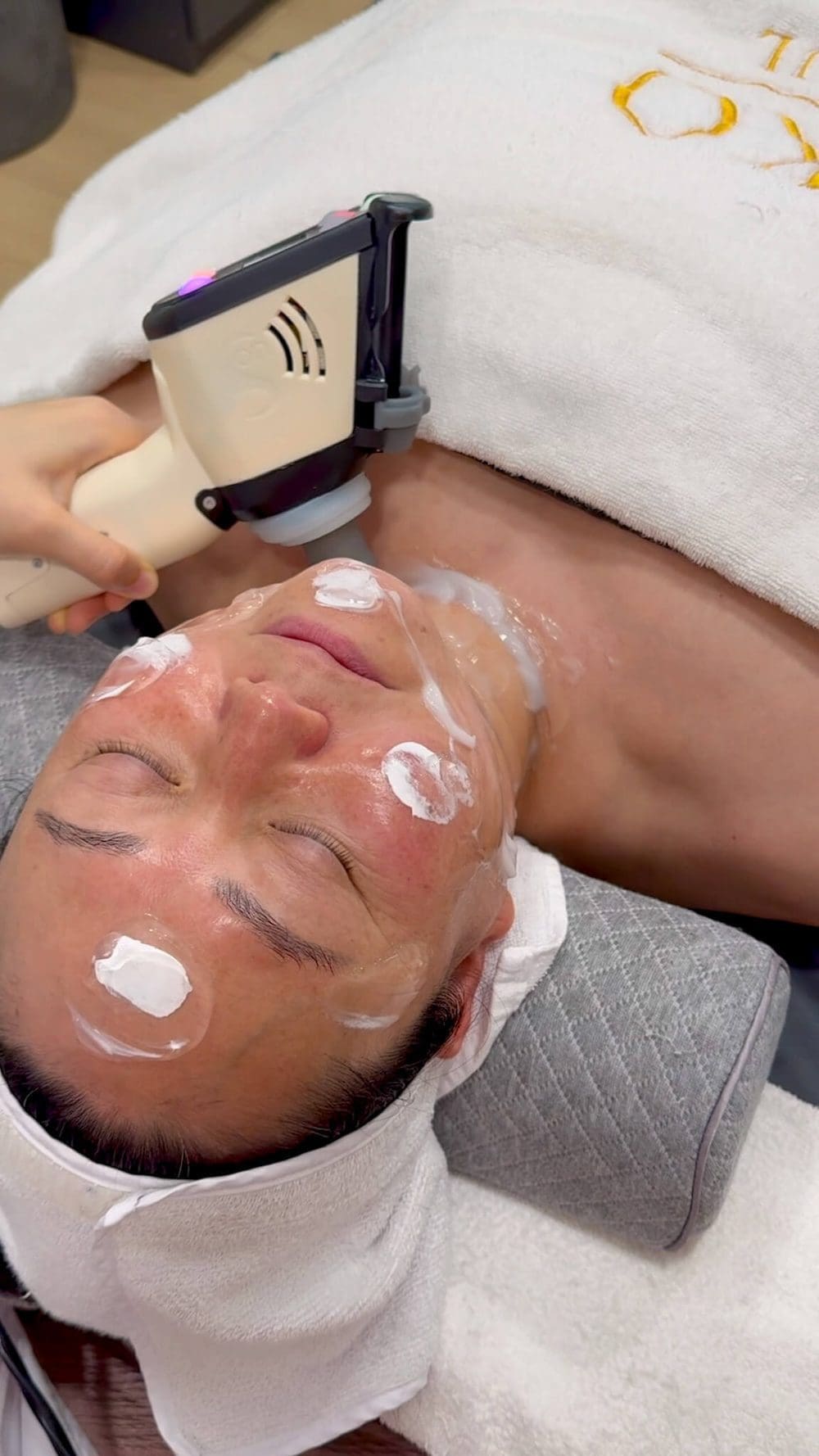 ultrasound lifting treatment in seoul | individuel geneve
