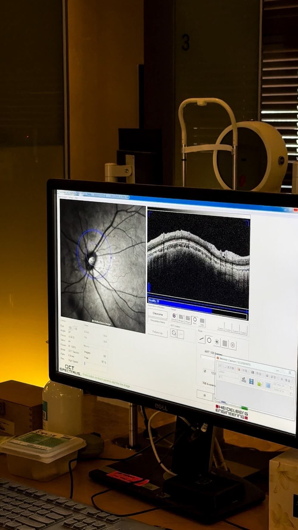 eye exam at bright eye clinic in seoul