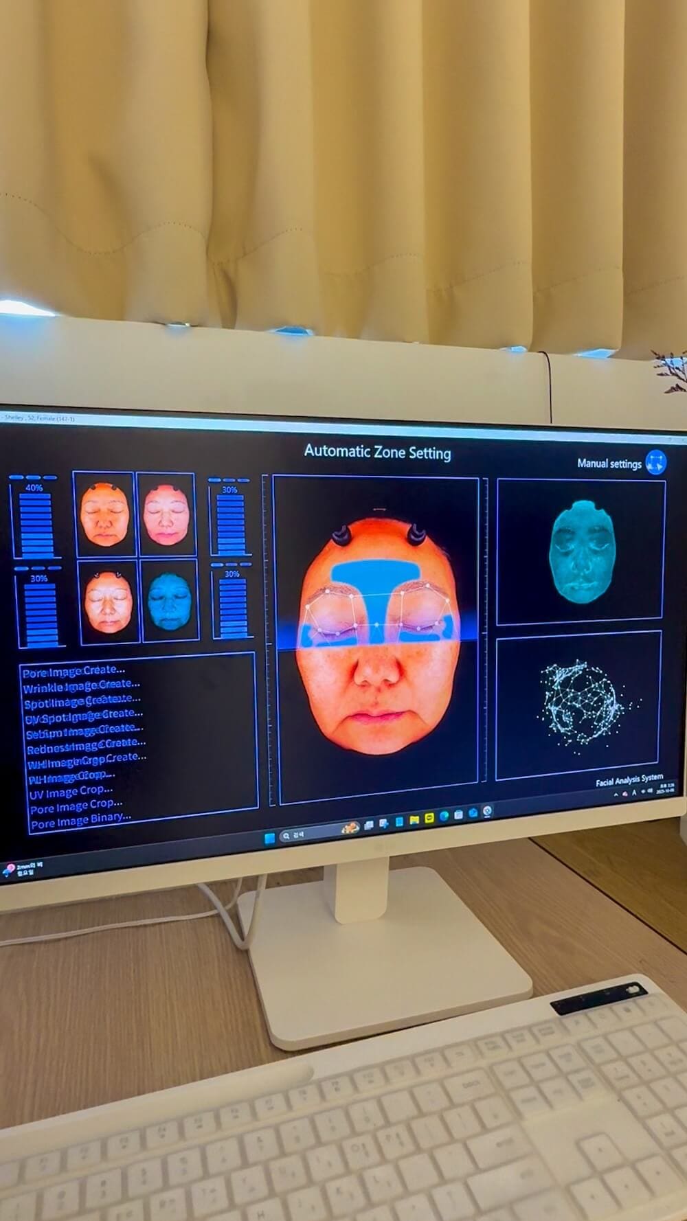 How to Save on Skin Treatments in Korea: Insights From Trying Over 20 Seoul Beauty Clinics Myself 23 skin analysis at a skin clinic in seoul