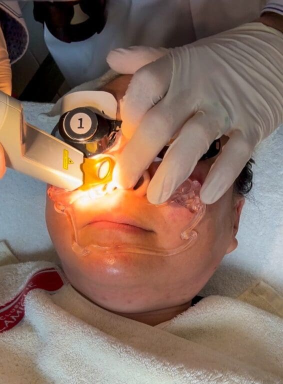 How to Save on Skin Treatments in Korea: Insights From Trying Over 20 Seoul Beauty Clinics Myself 12 skin treatments in korea | Excel V laser