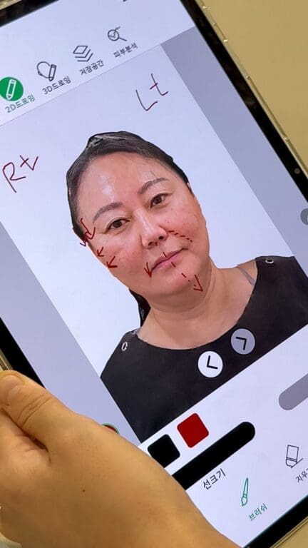 ai facial analysis at Duna Clinic in Seoul